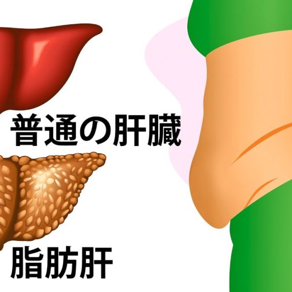 肝臓が助けを求めている10のサイン
